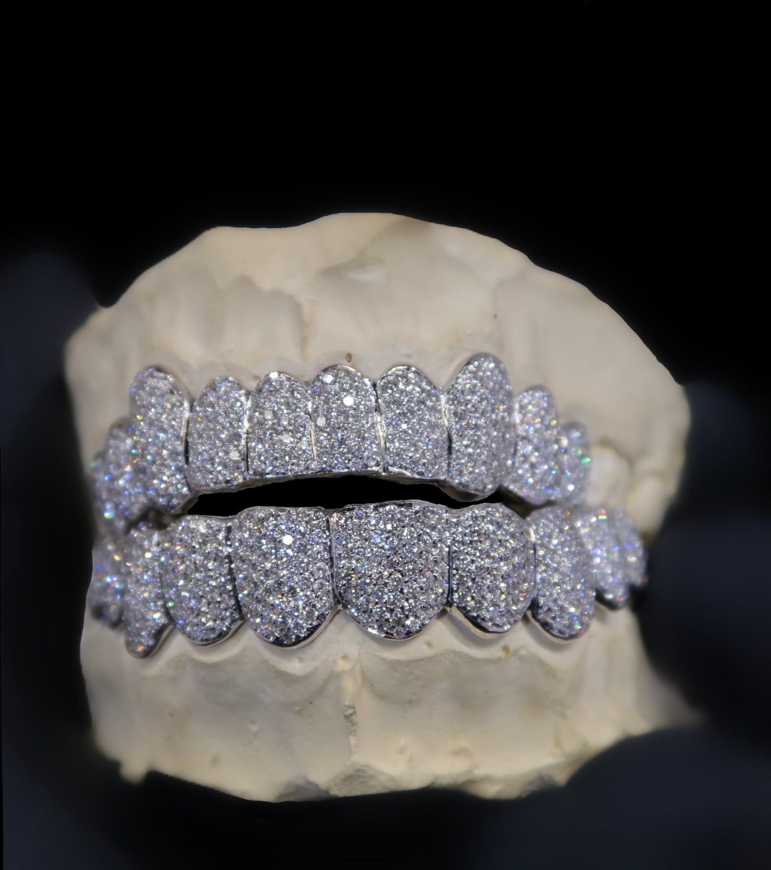 VVS, Diamond Grillz, Grillz, 